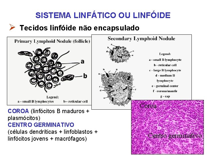 SISTEMA LINFÁTICO OU LINFÓIDE Ø Tecidos linfóide não encapsulado COROA (linfócitos B maduros + SISTEMA LINFÁTICO OU LINFÓIDE Ø Tecidos linfóide não encapsulado COROA (linfócitos B maduros +