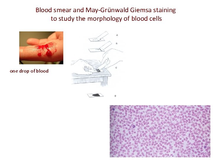 Blood smear and May-Grünwald Giemsa staining to study the morphology of blood cells one