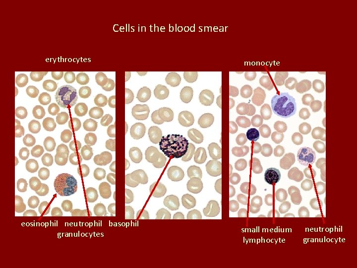 Cells in the blood smear erythrocytes eosinophil neutrophil basophil granulocytes monocyte small medium lymphocyte