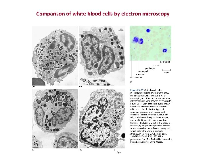 Comparison of white blood cells by electron microscopy 