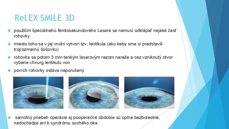 Re. LEX SMILE 3 D použitím špeciálneho femtosekundového Lasera sa nemusí odklápať nejaká časť