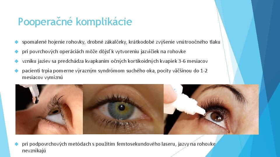 Pooperačné komplikácie spomalené hojenie rohovky, drobné zákalčeky, krátkodobé zvýšenie vnútroočného tlaku pri povrchových operáciách