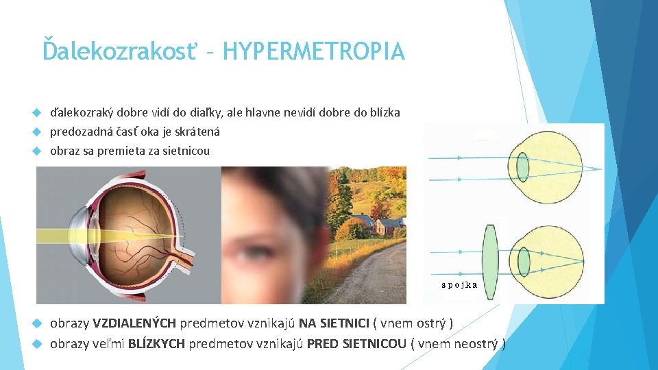 Ďalekozrakosť – HYPERMETROPIA ďalekozraký dobre vidí do diaľky, ale hlavne nevidí dobre do blízka