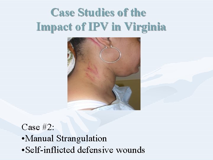 Case Studies of the Impact of IPV in Virginia Case #2: • Manual Strangulation