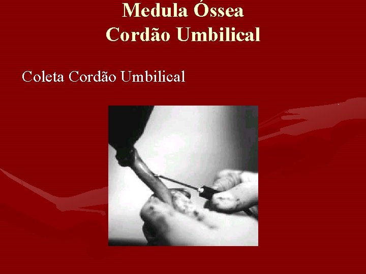 Medula Óssea Cordão Umbilical Coleta Cordão Umbilical Medula Óssea Cordão Umbilical Coleta Cordão Umbilical