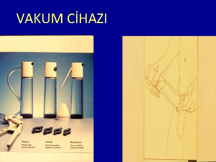 VAKUM CİHAZI 