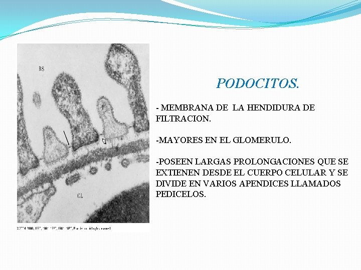 PODOCITOS. - MEMBRANA DE LA HENDIDURA DE FILTRACION. -MAYORES EN EL GLOMERULO. -POSEEN LARGAS PODOCITOS. - MEMBRANA DE LA HENDIDURA DE FILTRACION. -MAYORES EN EL GLOMERULO. -POSEEN LARGAS