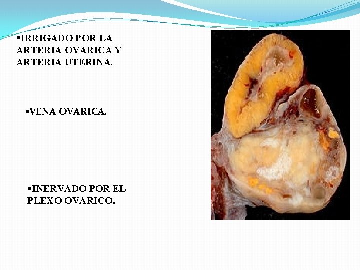 §IRRIGADO POR LA ARTERIA OVARICA Y ARTERIA UTERINA. §VENA OVARICA. §INERVADO POR EL PLEXO §IRRIGADO POR LA ARTERIA OVARICA Y ARTERIA UTERINA. §VENA OVARICA. §INERVADO POR EL PLEXO