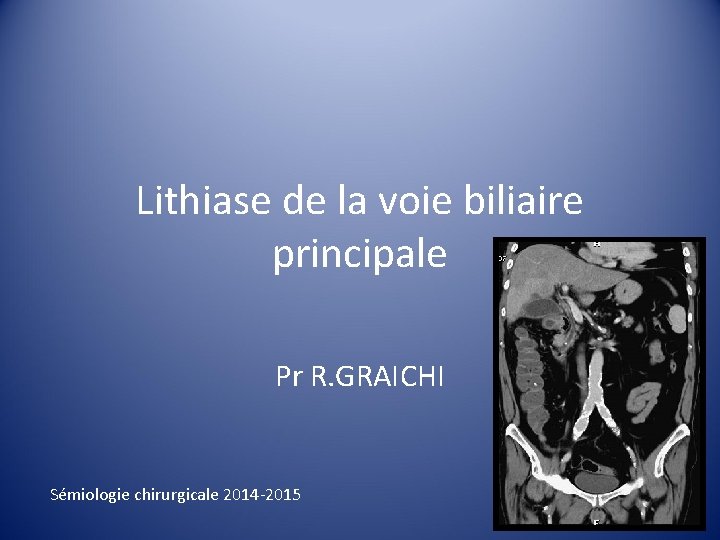 Lithiase de la voie biliaire principale Pr R. GRAICHI Sémiologie chirurgicale 2014 -2015 