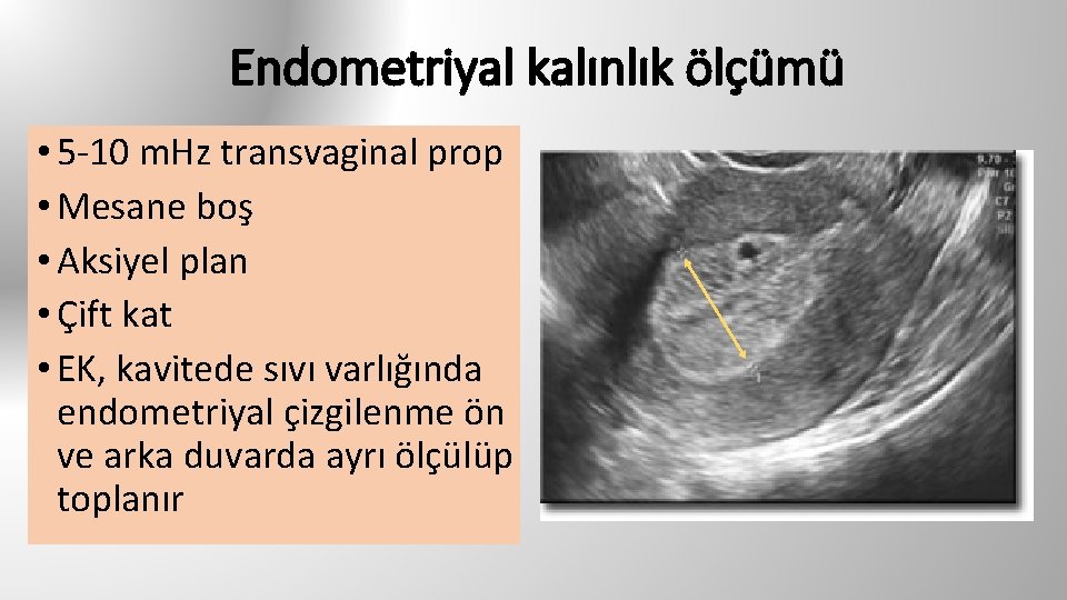 Endometriyal kalınlık ölçümü • 5 -10 m. Hz transvaginal prop • Mesane boş •