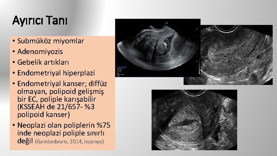 Ayırıcı Tanı • Submüköz miyomlar • Adenomiyozis • Gebelik artıkları • Endometriyal hiperplazi •