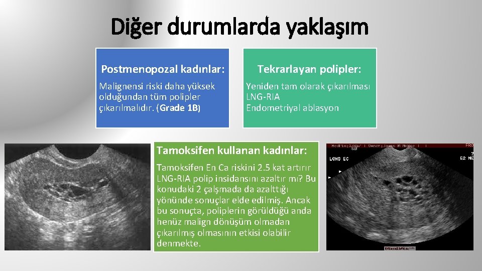 Diğer durumlarda yaklaşım Postmenopozal kadınlar: Malignensi riski daha yüksek olduğundan tüm polipler çıkarılmalıdır. (Grade