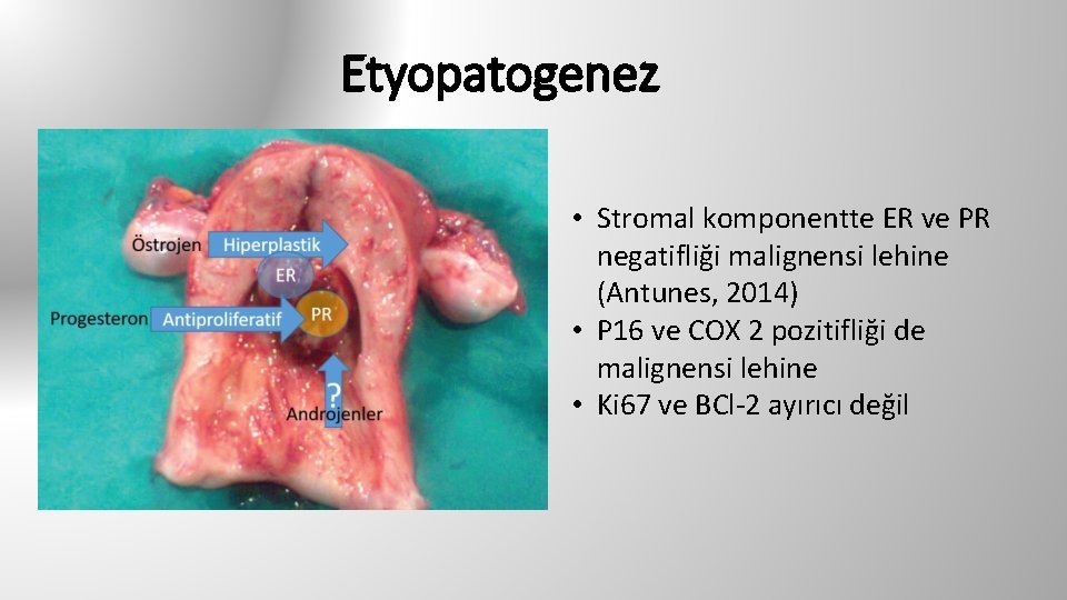 Etyopatogenez • Stromal komponentte ER ve PR negatifliği malignensi lehine (Antunes, 2014) • P