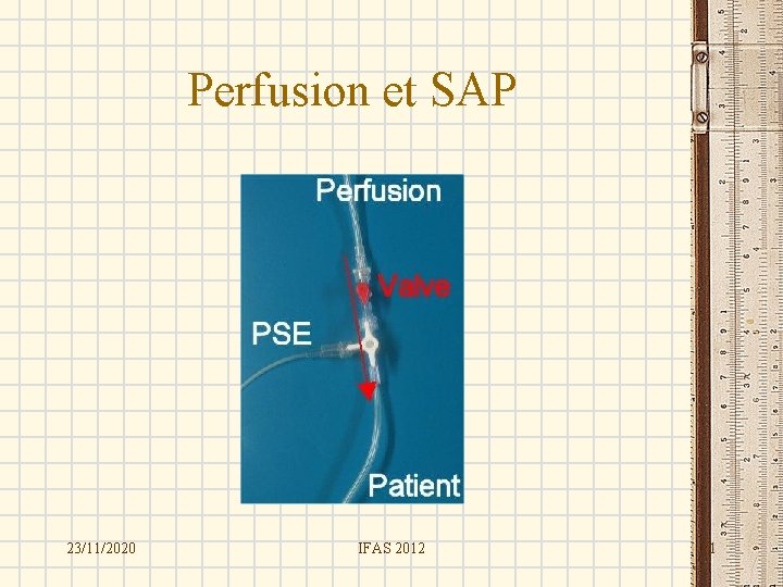 Perfusion et SAP 23/11/2020 IFAS 2012 11 