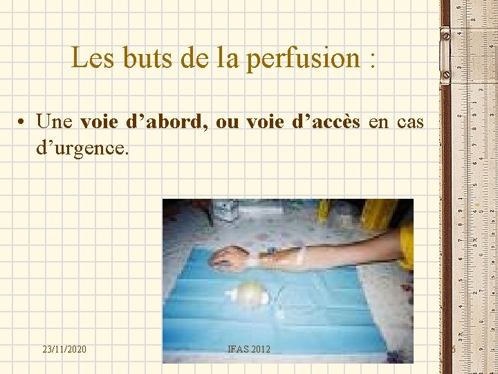 Les buts de la perfusion : • Une voie d’abord, ou voie d’accès en