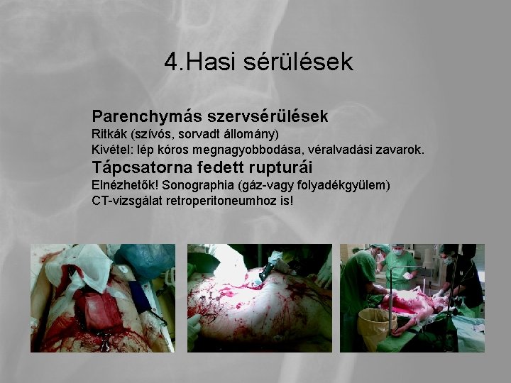 4. Hasi sérülések Parenchymás szervsérülések Ritkák (szívós, sorvadt állomány) Kivétel: lép kóros megnagyobbodása, véralvadási