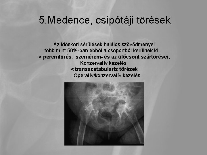 5. Medence, csípótáji törések. Az időskori sérülések halálos szövődményei több mint 50%-ban ebből a