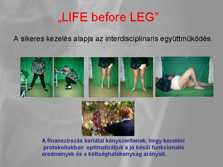 „LIFE before LEG” A sikeres kezelés alapja az interdisciplinaris együttműködés. A finanszírozás korlátai kényszerítenek,
