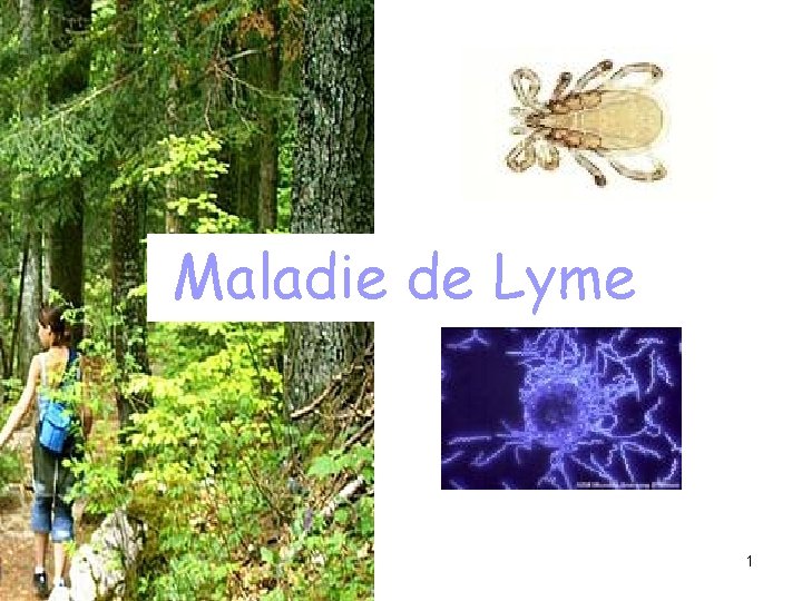 Maladie de Lyme 1 