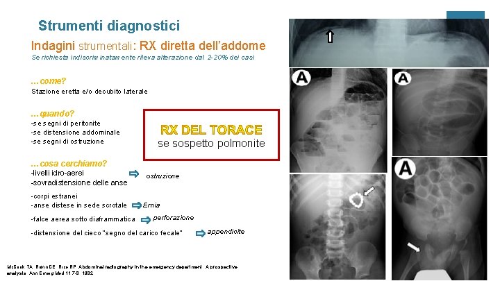 Strumenti diagnostici Indagini strumentali: RX diretta dell’addome Se richiesta indiscriminatamente rileva alterazione dal 2