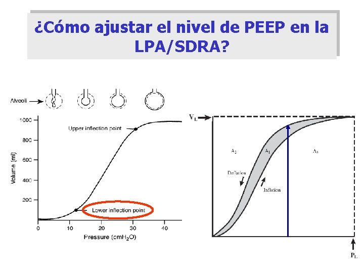 ¿Cómo ajustar el nivel de PEEP en la LPA/SDRA? 