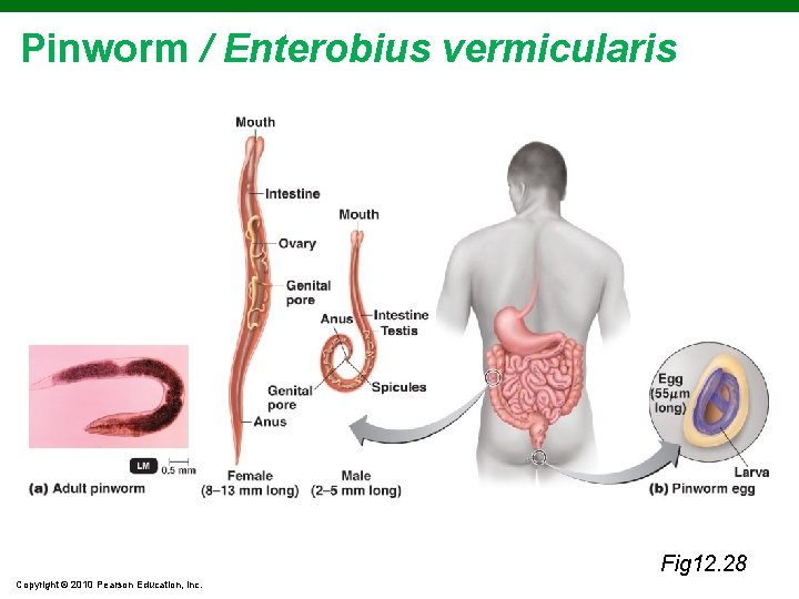 Pinworm / Enterobius vermicularis Fig 12. 28 Copyright © 2010 Pearson Education, Inc. 