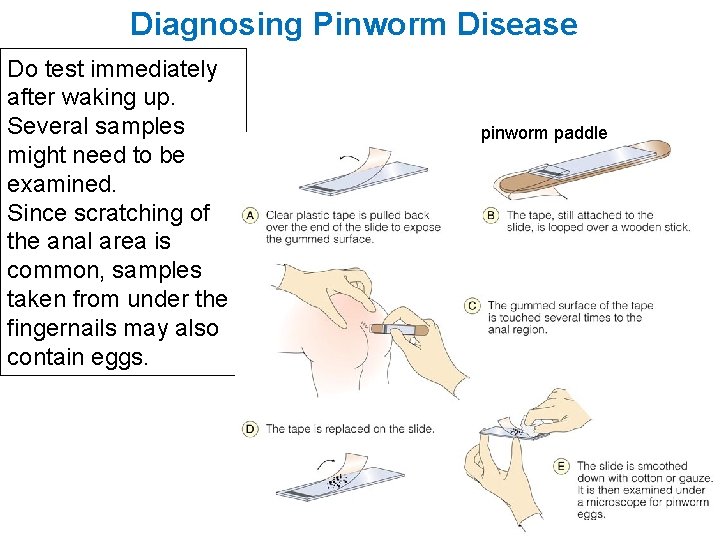 Diagnosing Pinworm Disease Do test immediately after waking up. Several samples might need to