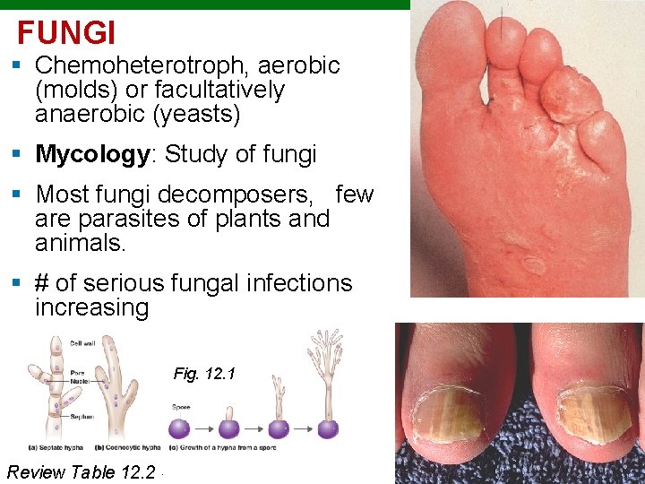FUNGI § Chemoheterotroph, aerobic (molds) or facultatively anaerobic (yeasts) § Mycology: Study of fungi