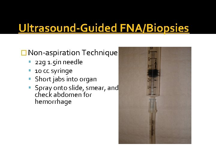 Ultrasound-Guided FNA/Biopsies � Non-aspiration Technique 22 g 1. 5 in needle 10 cc syringe