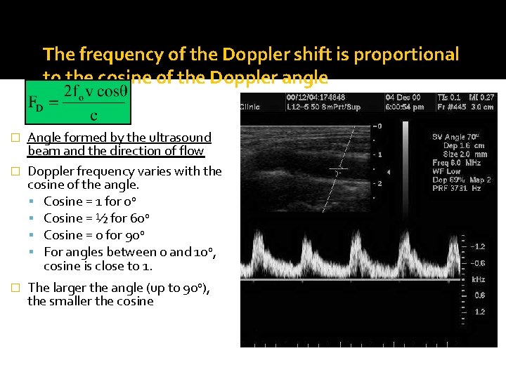 The frequency of the Doppler shift is proportional to the cosine of the Doppler