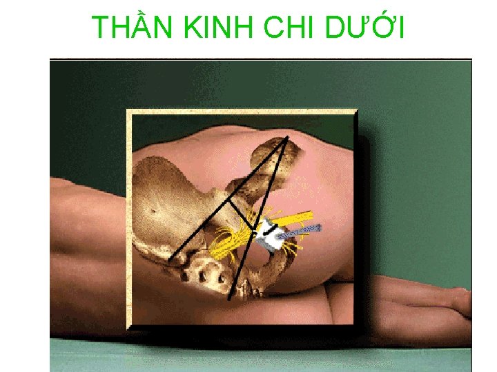 THẦN KINH CHI DƯỚI 