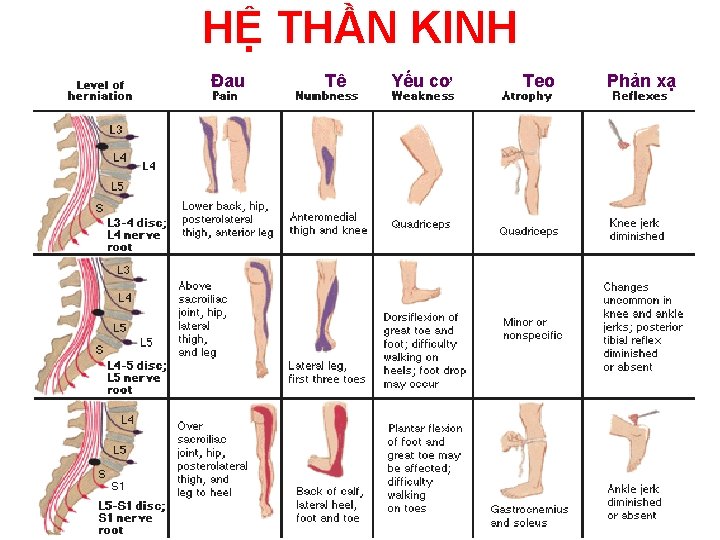 HỆ THẦN KINH Đau Tê Yếu cơ Teo Phản xạ 