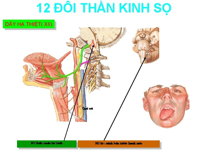 12 ĐÔI THẦN KINH SỌ D Y HẠ THIỆT( XII) Quai coå NU thaät: