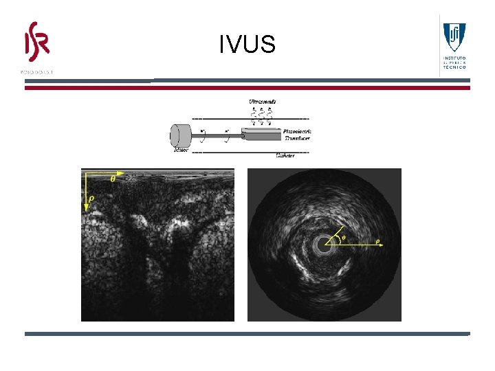 Ivus Normal Range Tissue Characterization by Image Analysis for Diagnostic Purposes