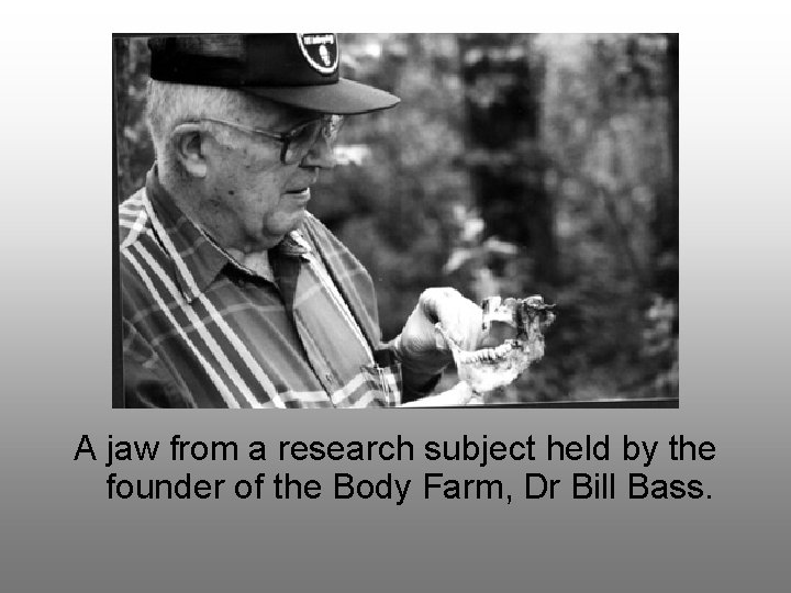 A jaw from a research subject held by the founder of the Body Farm,