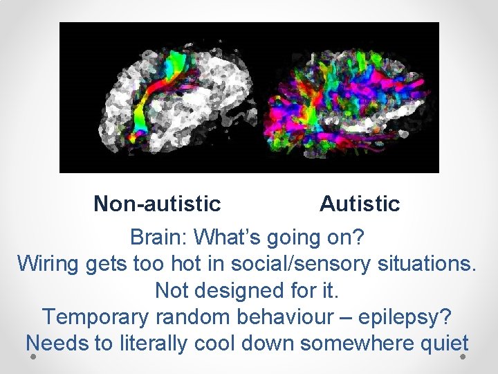 Non-autistic Autistic Brain: What’s going on? Wiring gets too hot in social/sensory situations. Not