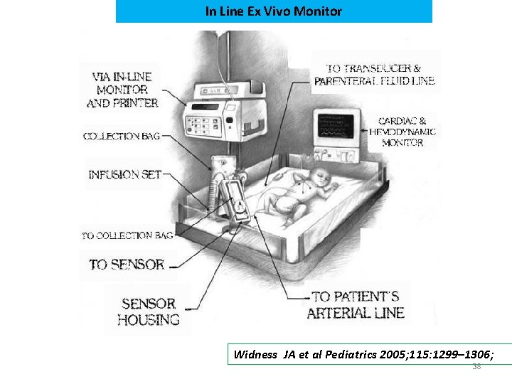 In Line Ex Vivo Monitor Widness JA et al Pediatrics 2005; 115: 1299– 1306;