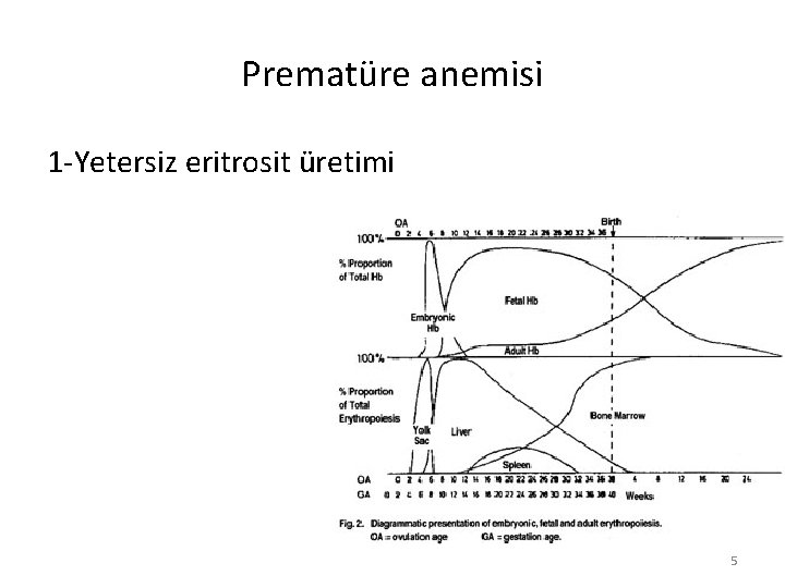 Prematüre anemisi 1 -Yetersiz eritrosit üretimi 5 