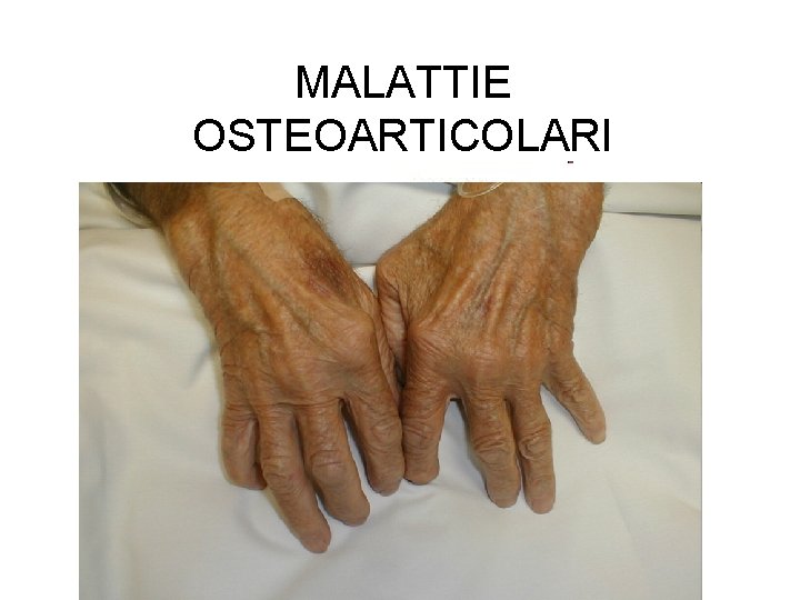 MALATTIE OSTEOARTICOLARI 