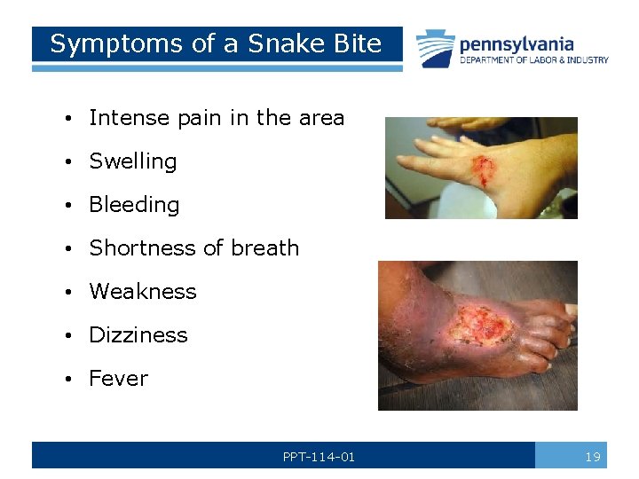 Symptoms of a Snake Bite • Intense pain in the area • Swelling •