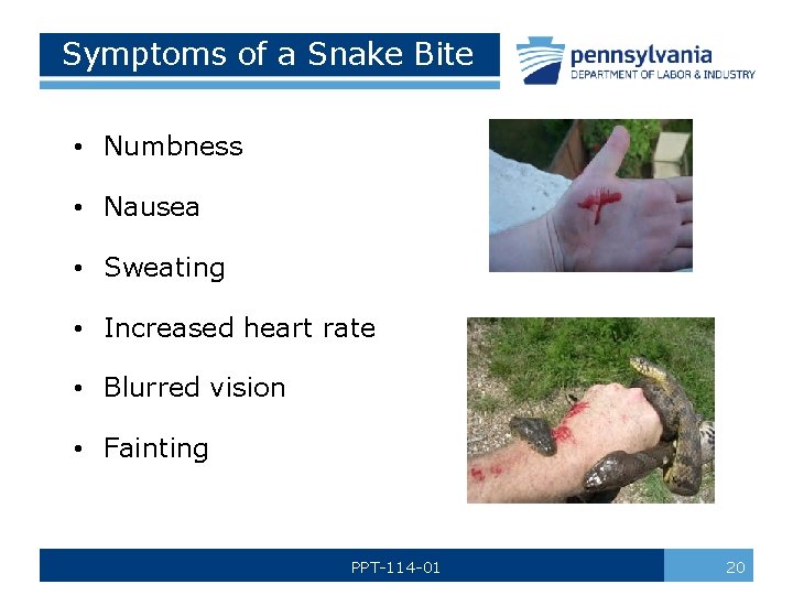 Symptoms of a Snake Bite • Numbness • Nausea • Sweating • Increased heart