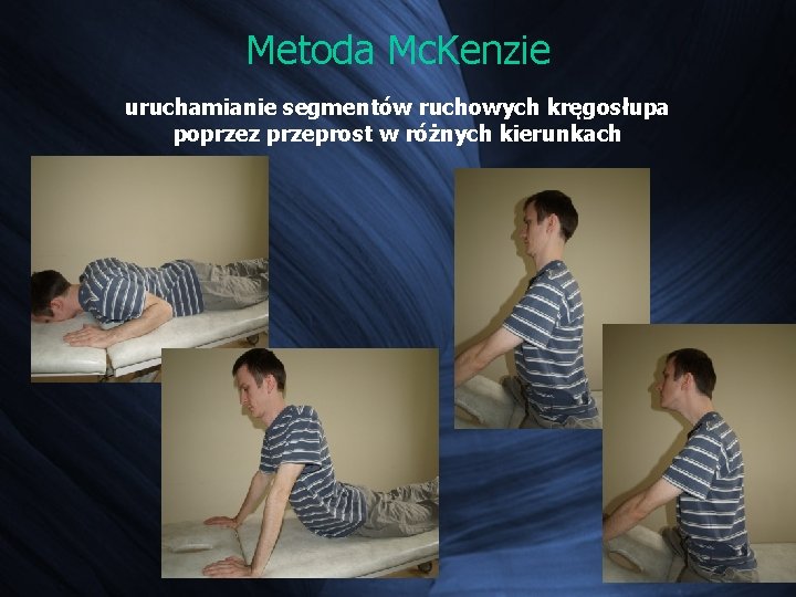 Metoda Mc. Kenzie uruchamianie segmentów ruchowych kręgosłupa poprzez przeprost w różnych kierunkach Metoda Mc. Kenzie uruchamianie segmentów ruchowych kręgosłupa poprzez przeprost w różnych kierunkach