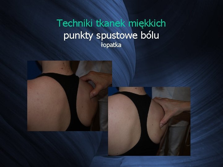 Techniki tkanek miękkich punkty spustowe bólu łopatka Techniki tkanek miękkich punkty spustowe bólu łopatka