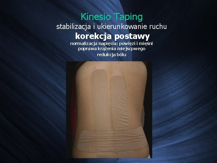 Kinesio Taping stabilizacja i ukierunkowanie ruchu korekcja postawy normalizacja napięcia: powięzi i mięśni poprawa Kinesio Taping stabilizacja i ukierunkowanie ruchu korekcja postawy normalizacja napięcia: powięzi i mięśni poprawa