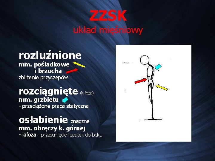 ZZSK układ mięśniowy rozluźnione mm. pośladkowe i brzucha zbliżenie przyczepów rozciągnięte (kifoza) mm. grzbietu ZZSK układ mięśniowy rozluźnione mm. pośladkowe i brzucha zbliżenie przyczepów rozciągnięte (kifoza) mm. grzbietu
