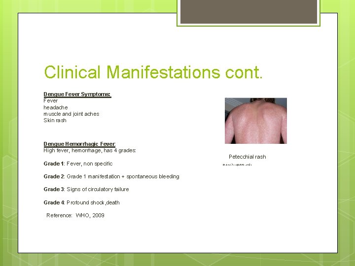 Clinical Manifestations cont. Dengue Fever Symptoms: Fever headache muscle and joint aches Skin rash
