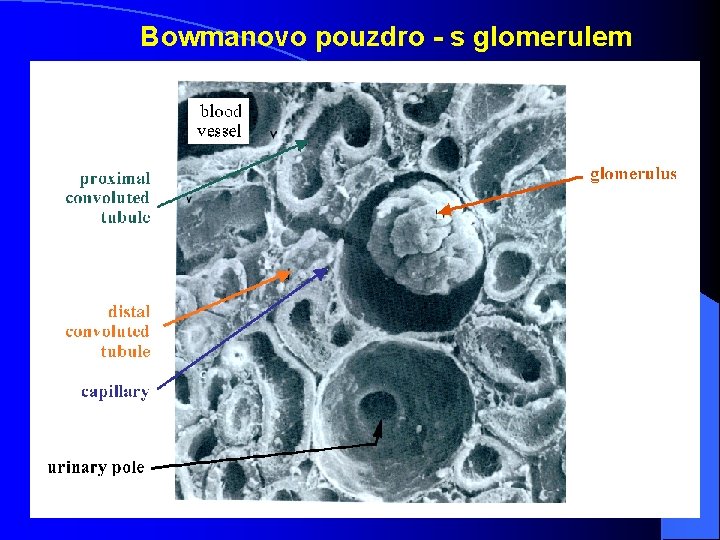 Bowmanovo pouzdro - s glomerulem Bowmanovo pouzdro - s glomerulem