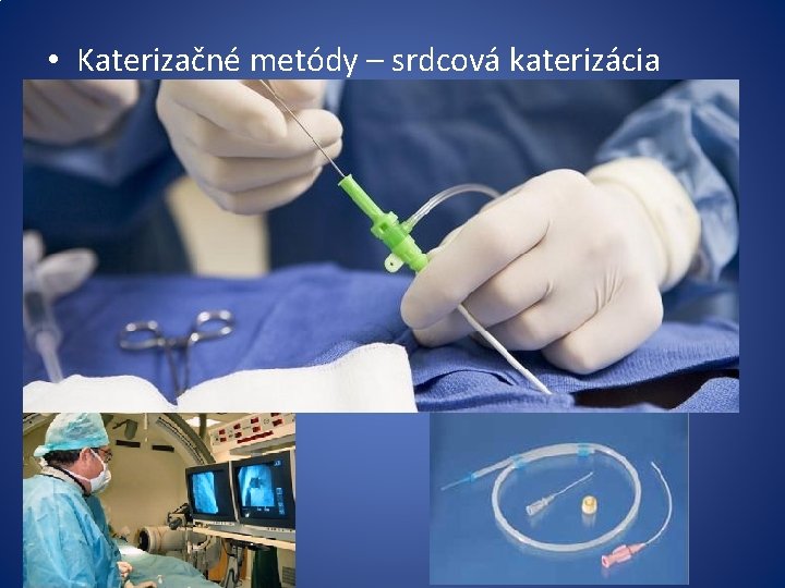  • Katerizačné metódy – srdcová katerizácia 