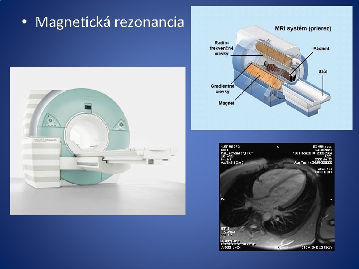  • Magnetická rezonancia 