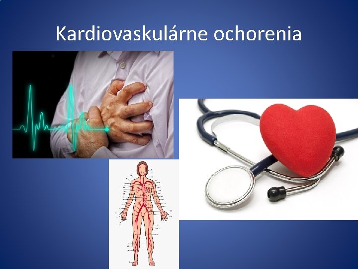Kardiovaskulárne ochorenia 